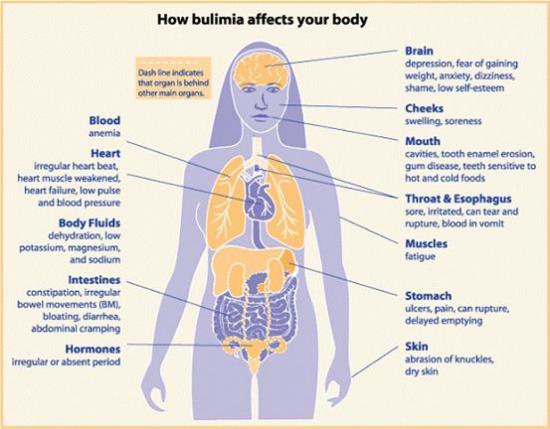 What are the consequences of vomiting on a regular basis? Expert answers & advice.