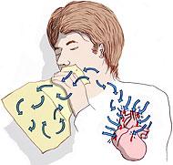What's the best way to calm your racing heart when having a panic attack? Expert answers & advice.