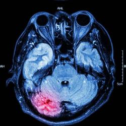 User Profile: braindamag3